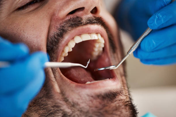Best Urgent Dental Care for Toothache in Frankenmuth, MI