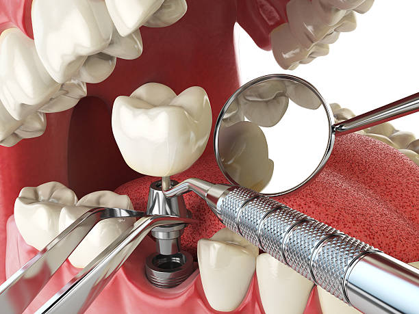 Best Mobile Emergency Dentist in Frankenmuth, MI